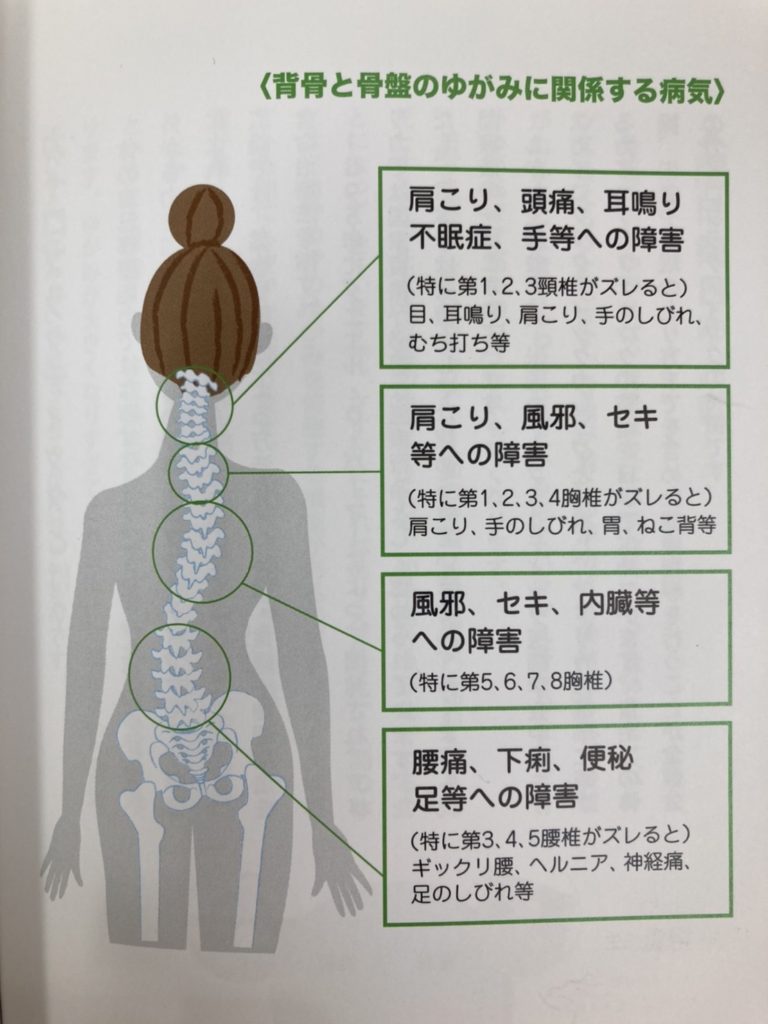 骨の歪み 歪みは万病のもと 骨盤と背骨の正しい関係とは 大阪の腰痛施術なら 大阪府箕面市 とくやま鍼灸接骨院